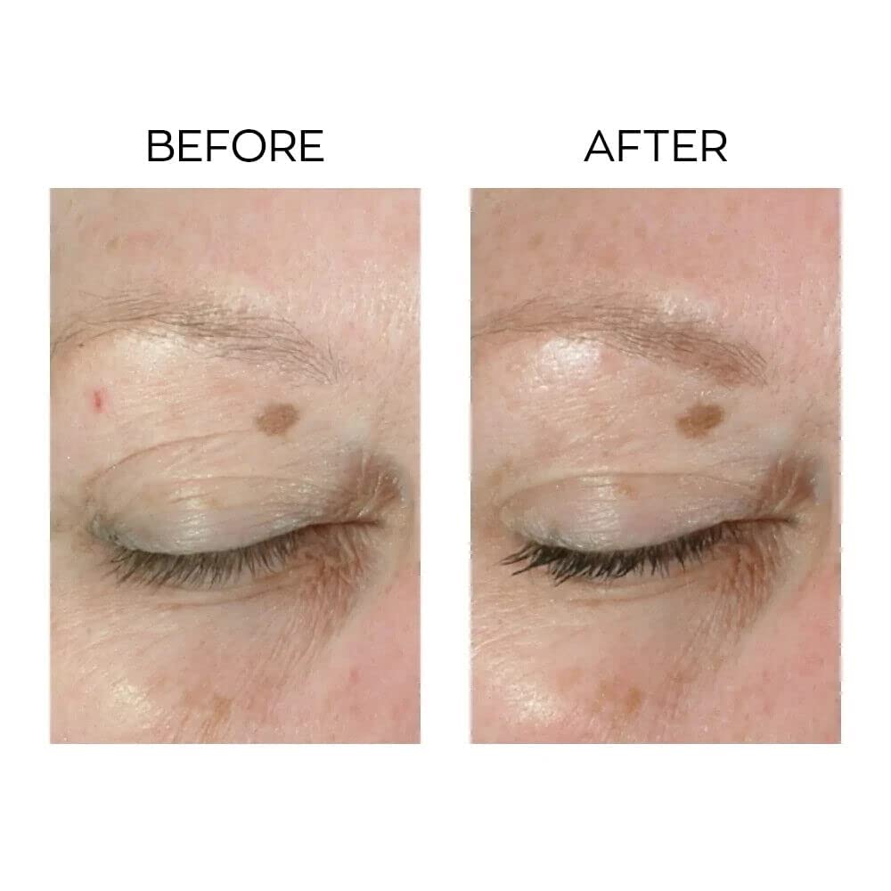 Anew Lifting Dual Eye System Anti Wrinkle Eye Cream PACK OF 2
