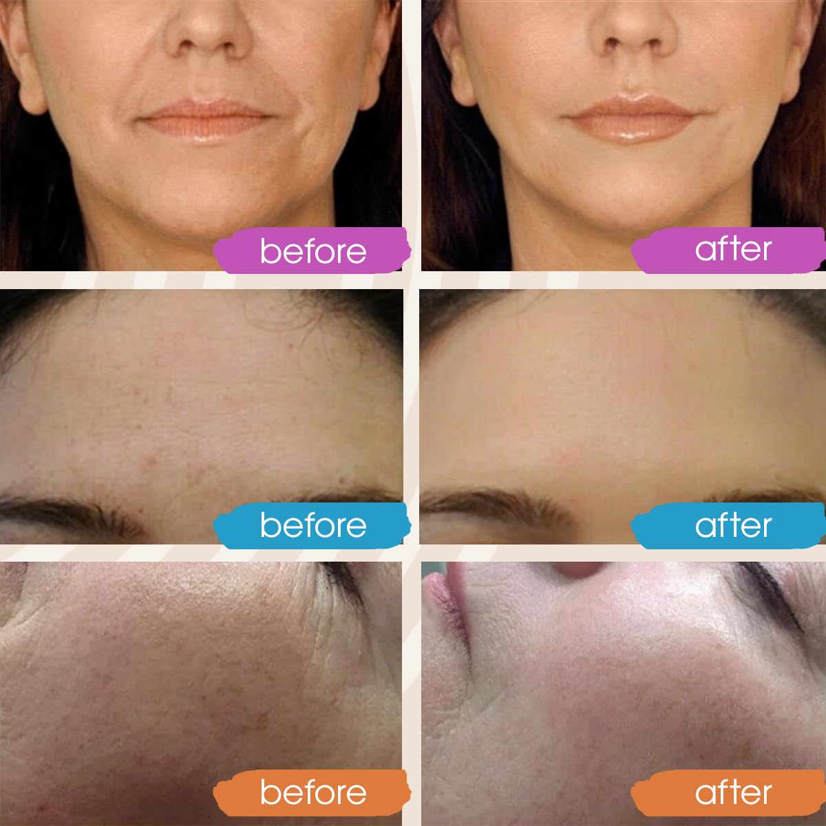 New 2024 Pure Hyaluronic Acid Serum for Face - Hydrating Serum for Women - Hyaluronic Acid Pure Face Serum for Women - Face Serum for Dry Skin with Dark Spots 2oz