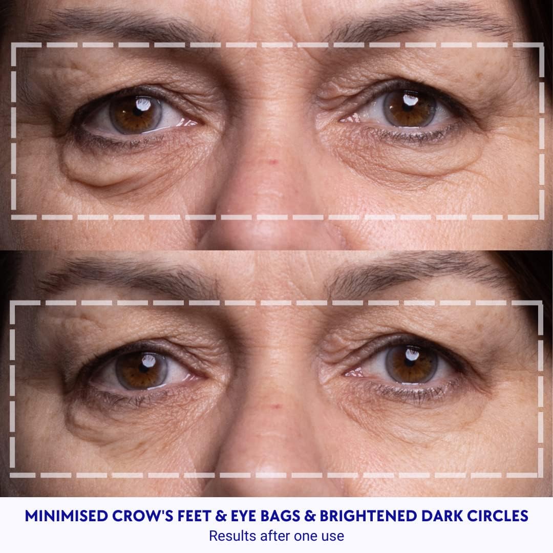 Wrinkles Schminkles Under Eye Wrinkle Patches | Smooth Eye Wrinkles, Crows Feet & Dark Circles Overnight | 6 Pairs Reusable Medical Grade Silicone Patches