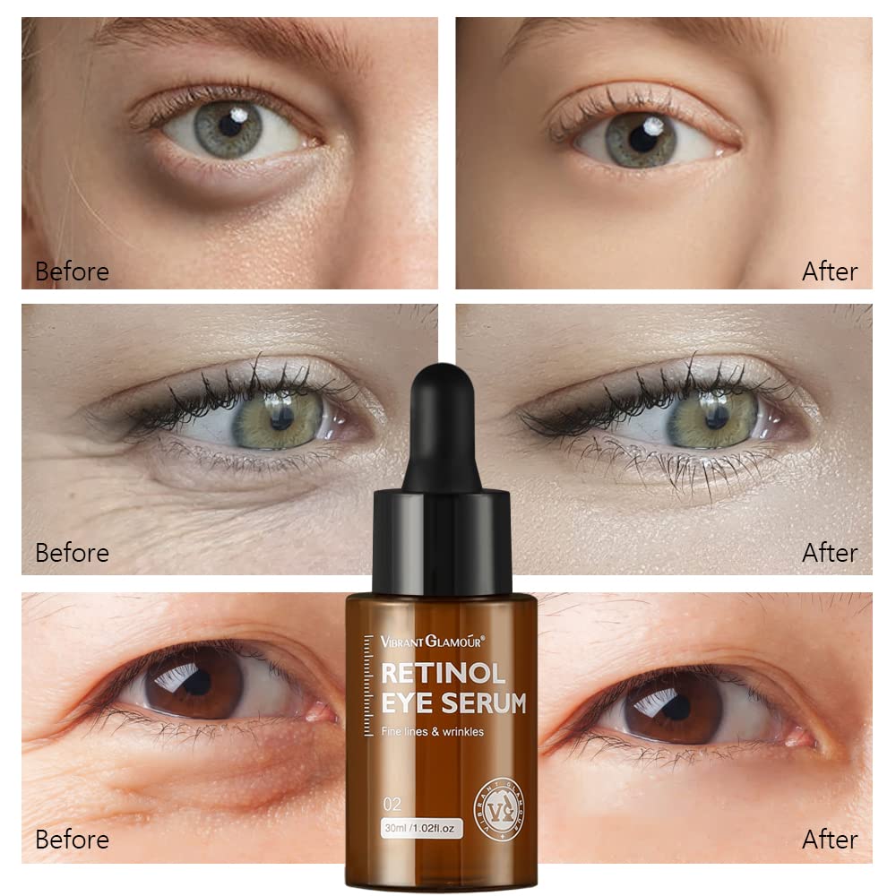 Retinol Eye Serum, Anti-Aging with Hyaluronic Acid Vitamin E Ceramide for Dark Circle, Fine Lines & Under Eye Bags Visibly Reduces, 1.02 fl.oz