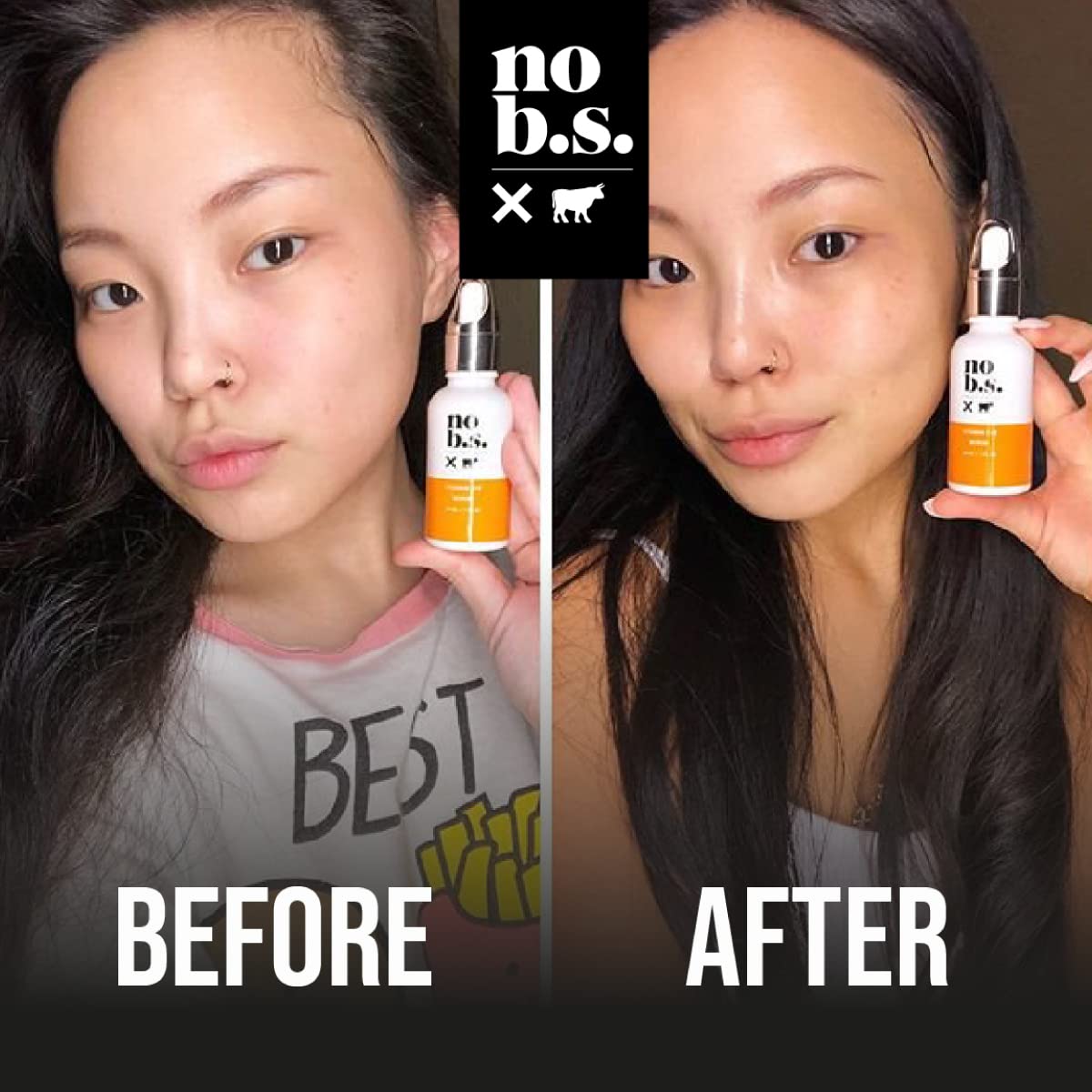 No B.S. (No Bad Stuff) Skincare Minis Kit, Vitamin C & E Serum with Hyaluronic Acid, Retinol Night Cream, Caffeine Eye Cream & Invisible, Waterproof Acne Patches, 4 Product Trial Size