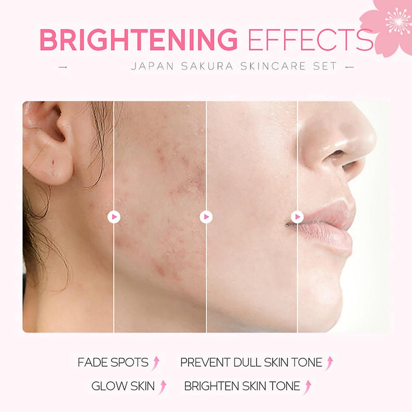Skincare Gifts For Teenage Girls,Cherry Blossom Skincare Sets,Facial kit,Pamper Sets For Women Gifts,Skin Care Sets & Kits (SetA)