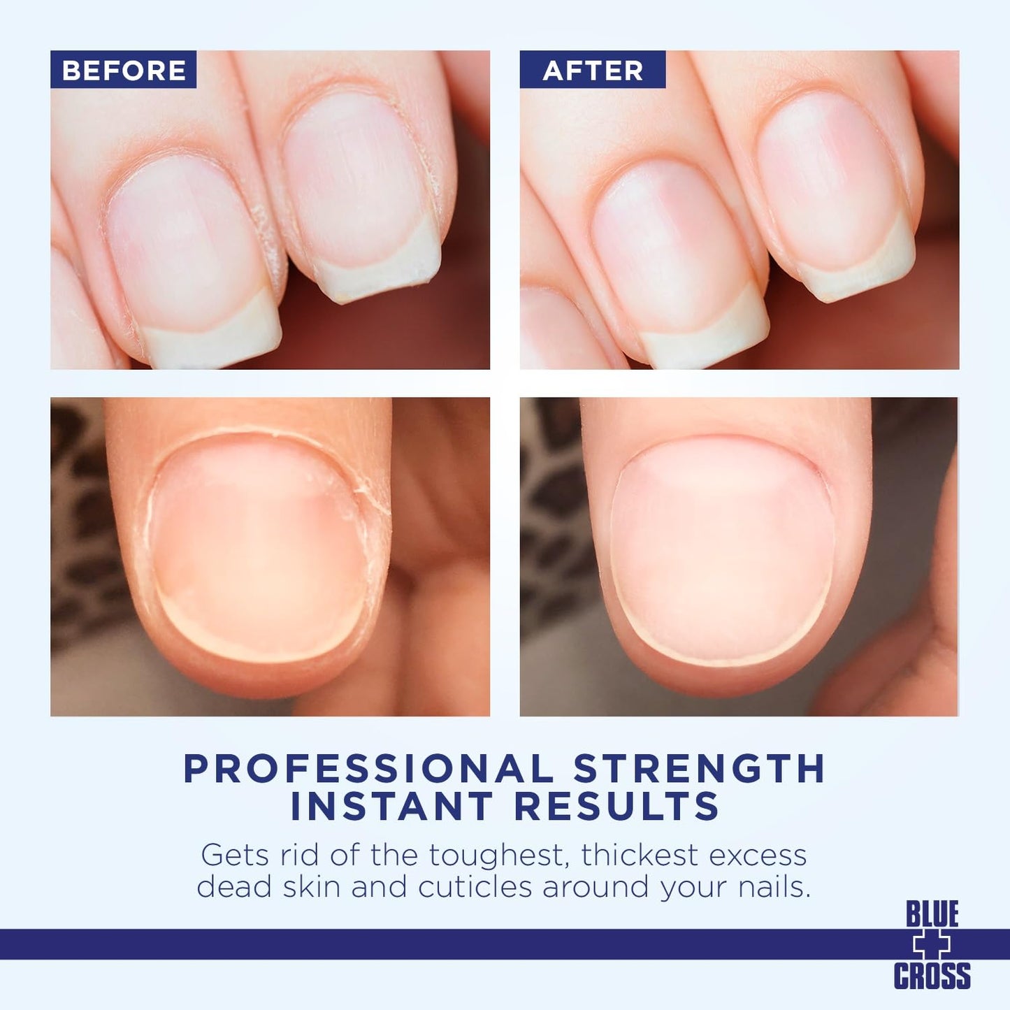 Blue Cross Cuticle Remover Liquid, Cuticle Softener for Nails, Professional Nail Care with Lanolin for Brittle Hang Nails, Hydrating, Moisturizing, Dry Cuticles, Made in USA. 16oz