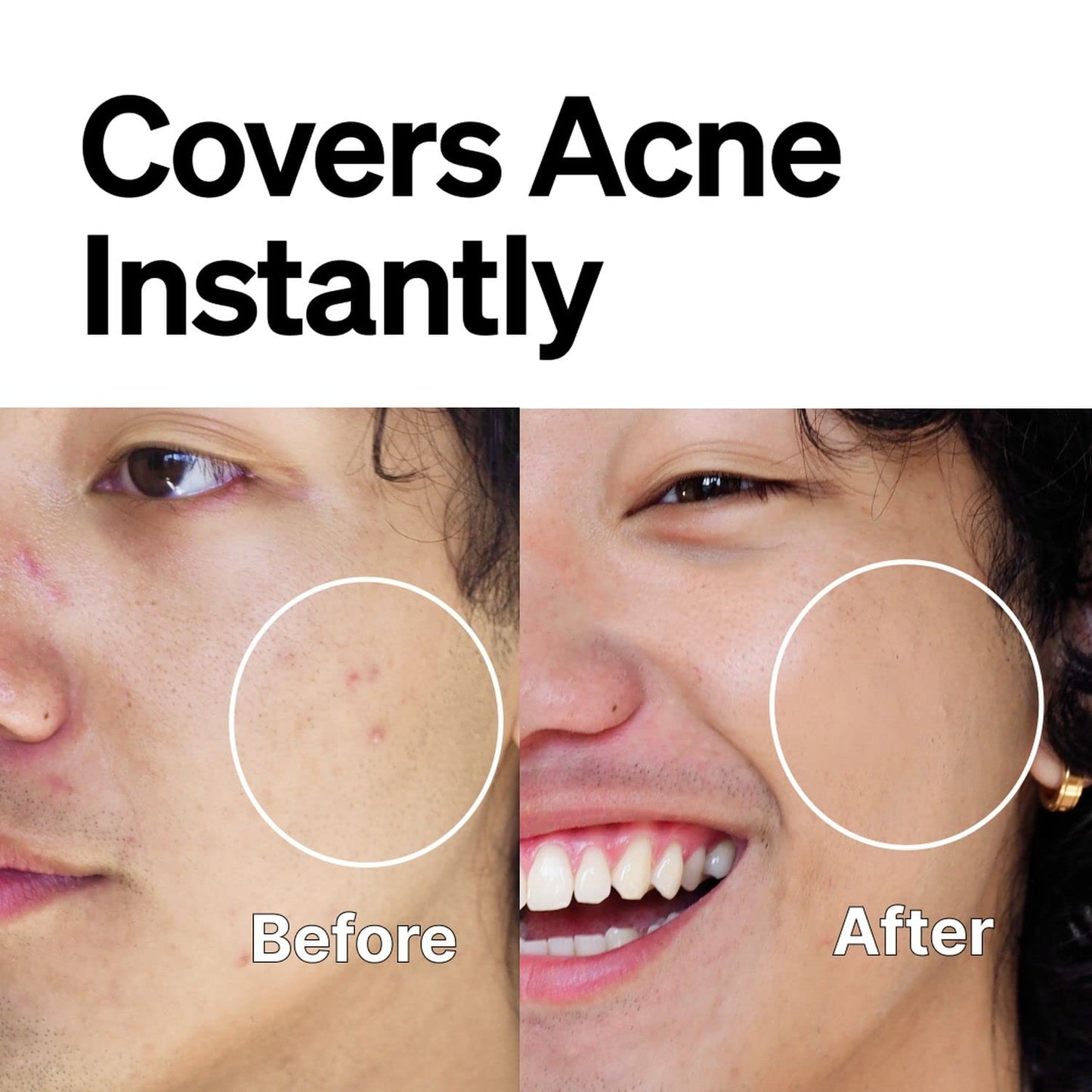 FRONTMAN Fade, Men's Acne Concealer With Salicylic Acid For Acne | For Blemishes & Dark Circles | Great for All Skin Types | Men’s Concealer D4 Dark Shade