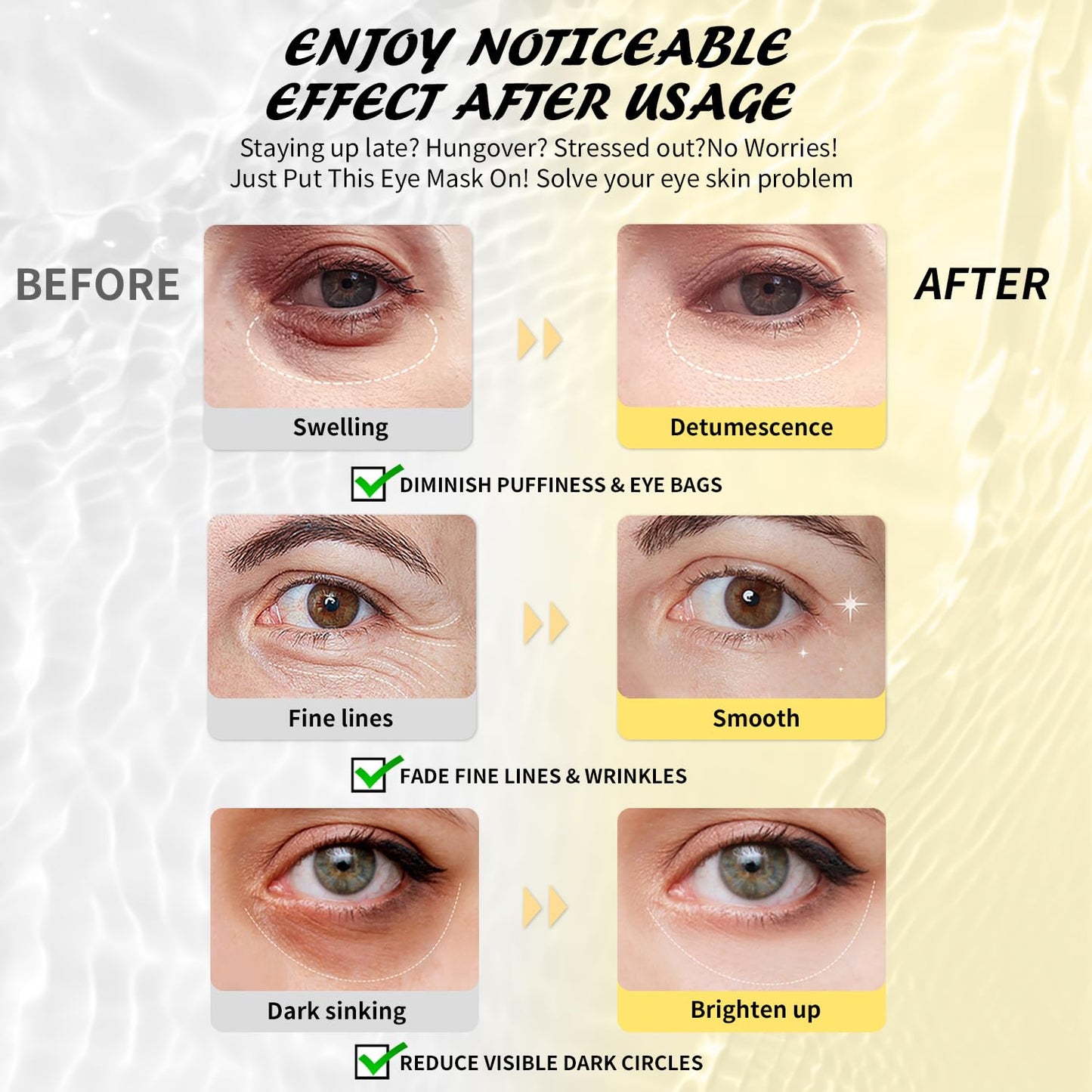 Under Eye Patches (50 Pairs), Caffeine Eye Masks for Dark Circles Puffy Eyes Undereye Bags, Collagen Eye Patches for Wrinkles and Puffiness, Skin Care Gift for Her