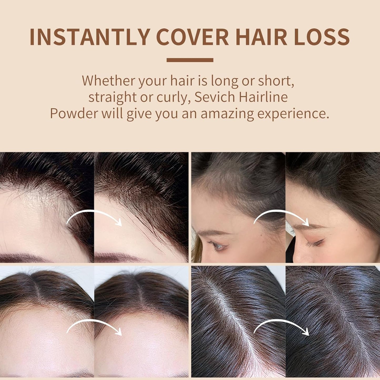 Sevich Hairline Powder，Instantly Conceals Hair Loss, Root Touch up Powder, Hair Shadow Toppers for Women & Men, Touch Up for Thinning Gray Hair, Windproof & Sweatproof, Medium Brown