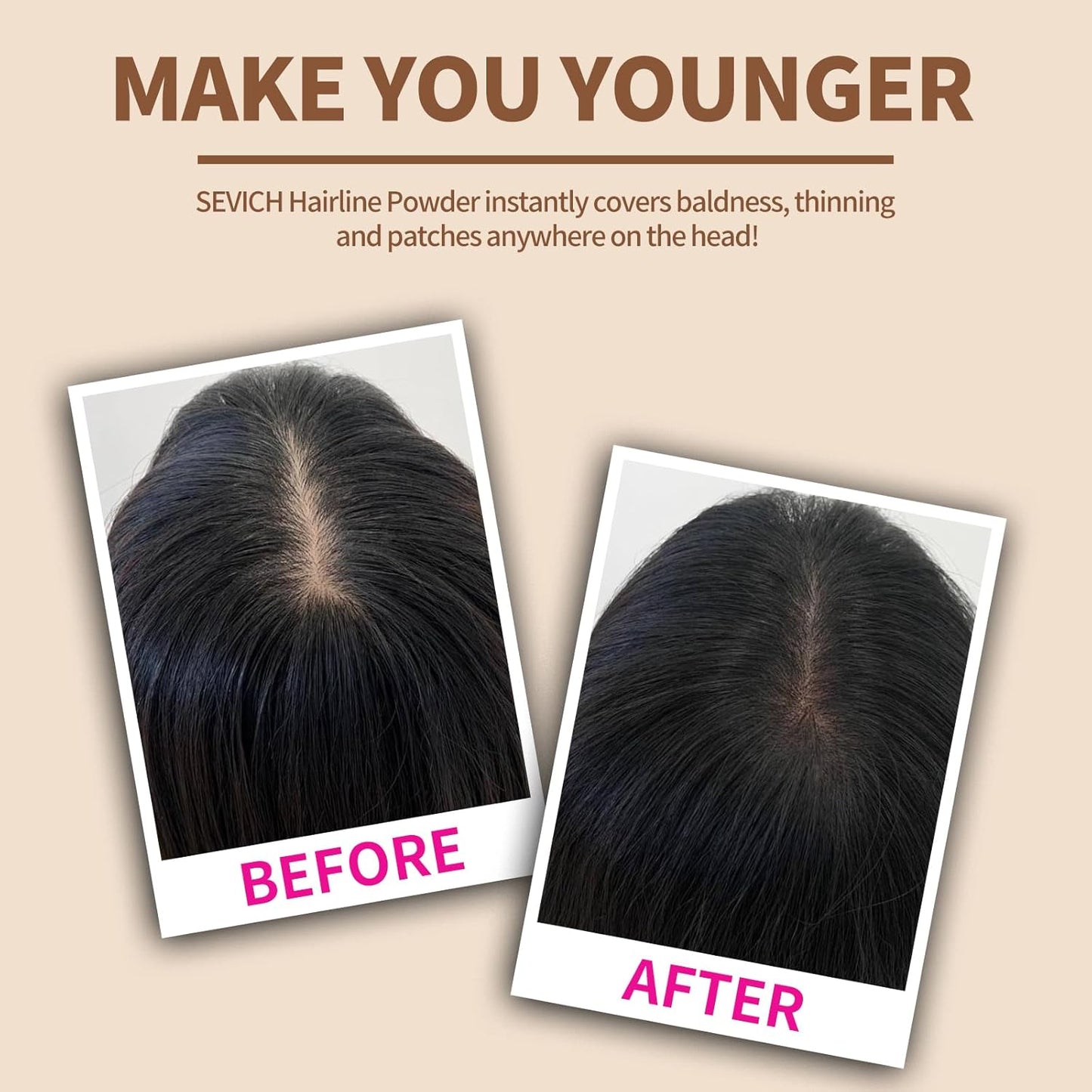 Sevich Hairline Powder，Instantly Conceals Hair Loss, Root Touch up Powder, Hair Shadow Toppers for Women & Men, Touch Up for Thinning Gray Hair, Windproof & Sweatproof, Black