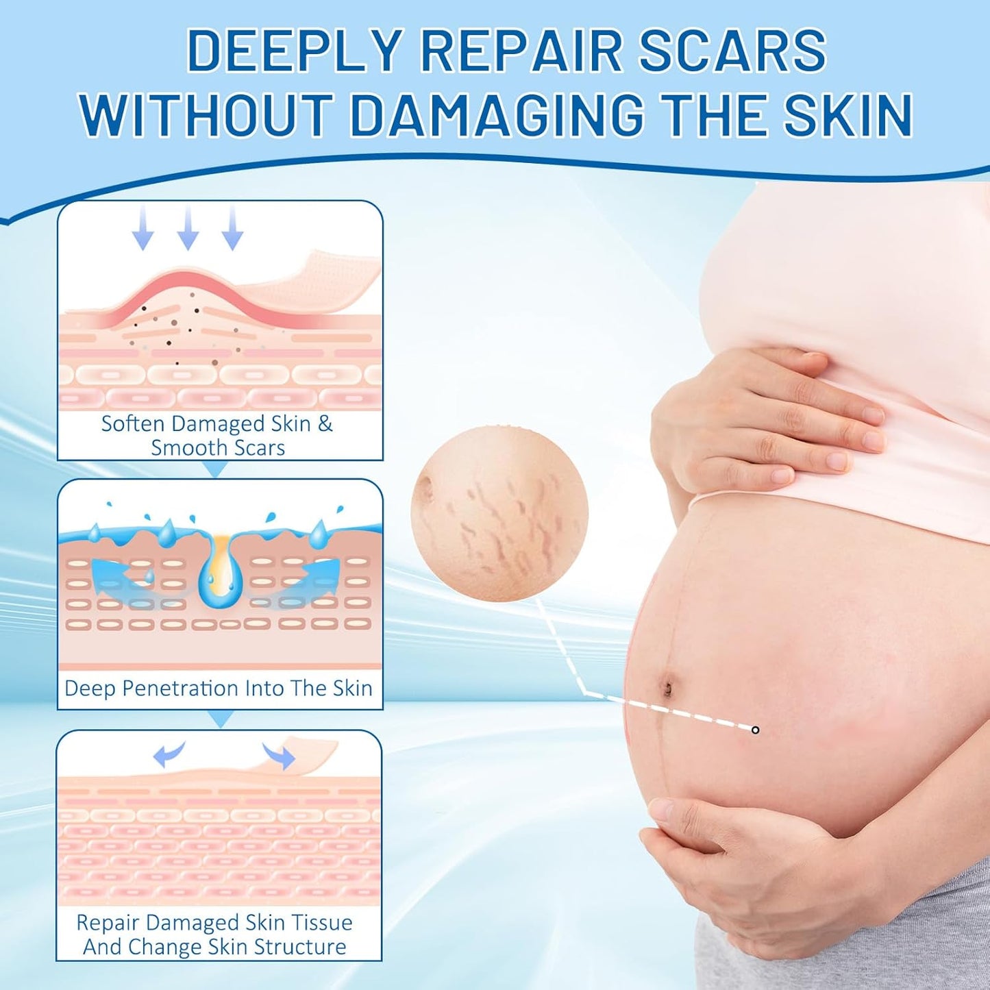 Stretch Mark Removal, Stretch Mark Cream for Pregnancy, Scar Removal Cream Deep Stretch Mark Removal, Belly Butter for Pregnant Women To Prevent And Repair Maternity Stretch Marks Scar 2.82 Oz
