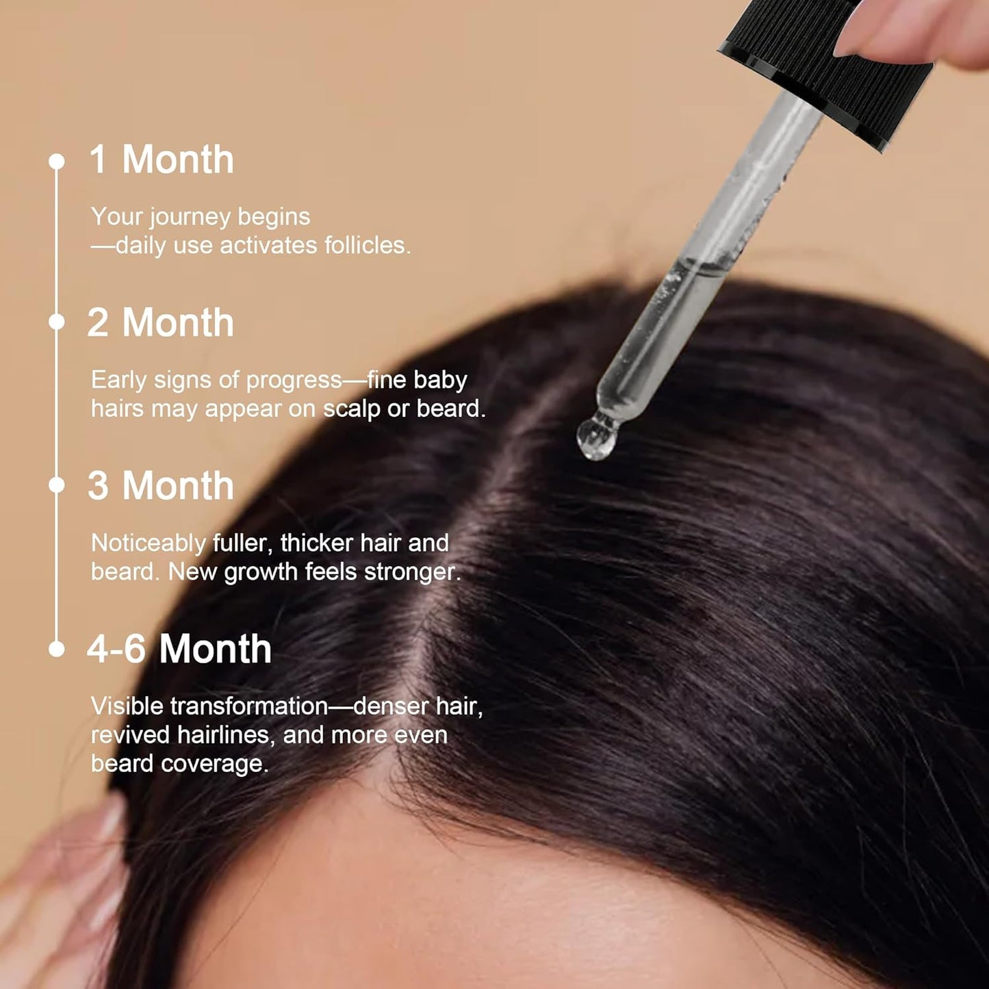 5% Minoxidil Hair Growth Serum, Topical Minoxidil for Men and Women, Hair Regrowth Treatment for Scalp Hair Loss and Thinning, With Biotin - 2.02 Fl oz