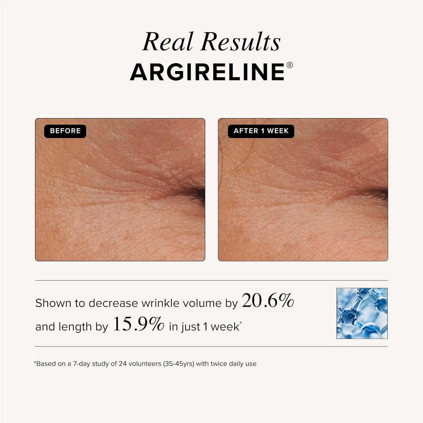 Asterwood Triple Repair Matrixyl 3000 + Argireline + Hyaluronic Acid + Vitamin C Serum for Face - Anti-Aging, Collagen Boosting, Hydrating - Fragrance-Free - 4 Fl Oz