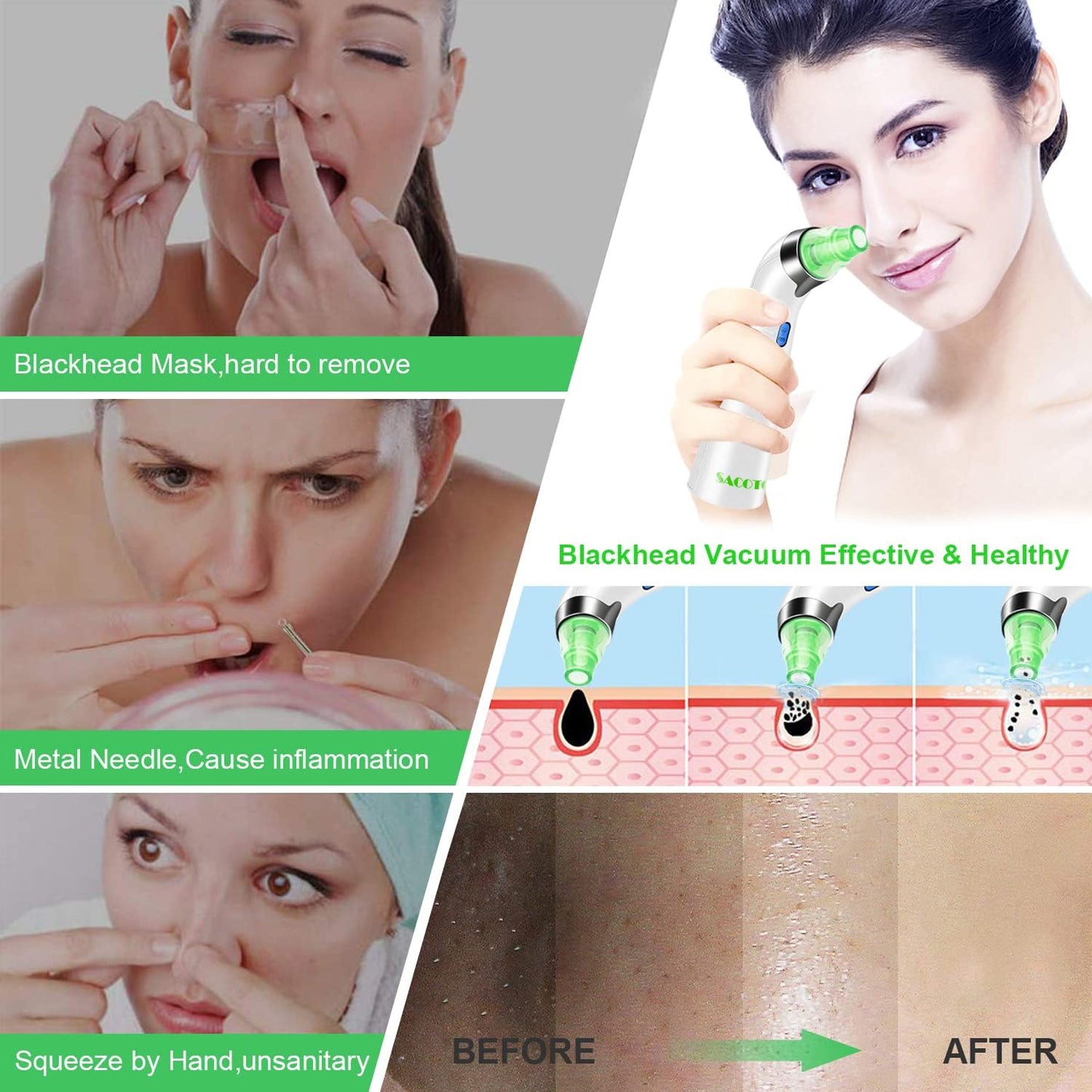 Blackhead Remover Pore Vacuum, Face Suction Pore Cleanser, 5 Suction Power Electric Blackhead Extractor Tool, 4 Probes, Blackhead Suction Remover for Women & Men