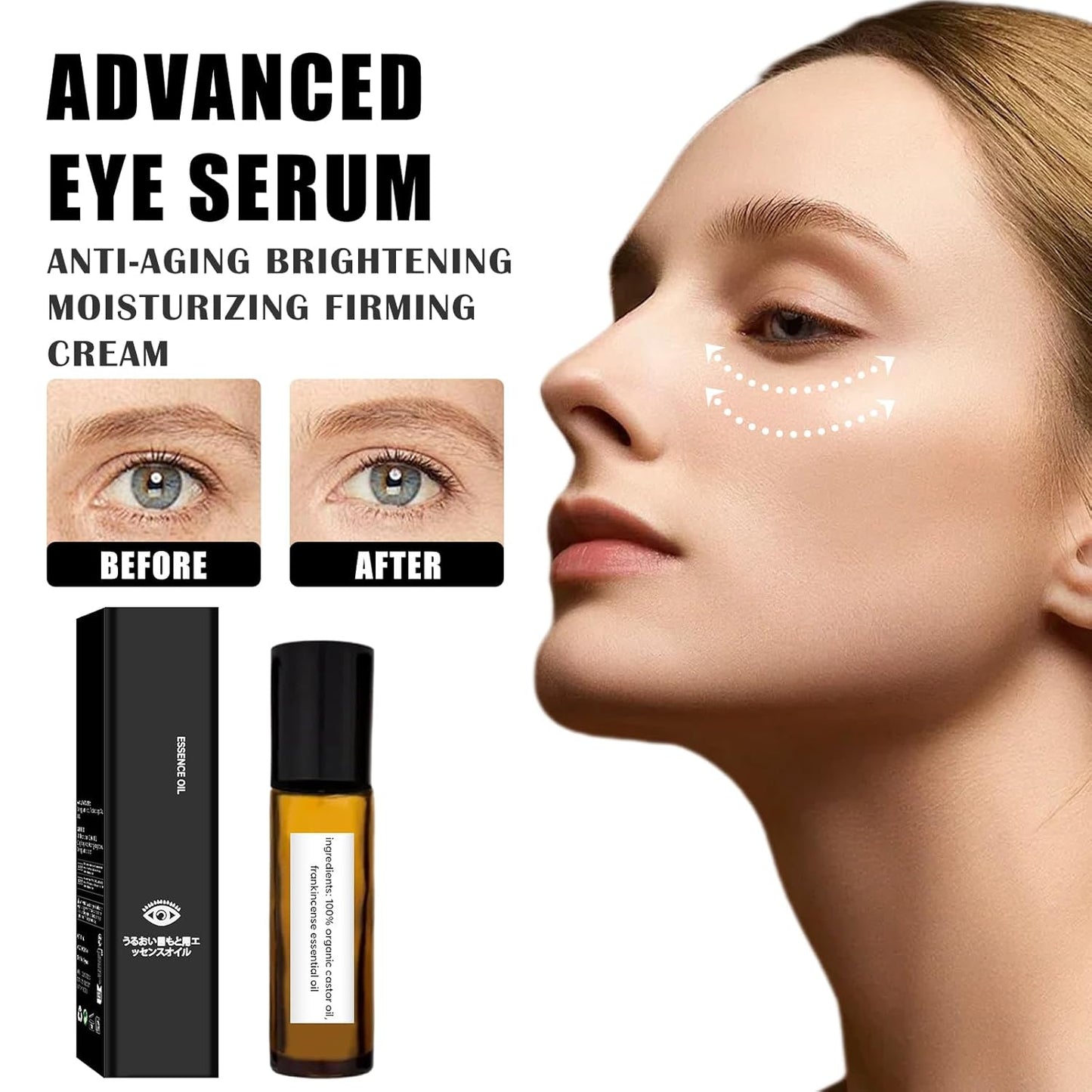 Time Eraser Roller Ball Castor Oil, Castor Oil Frankincense Rollerball, Time Eraser Rollerball for Eyes, Bags Under Eyes, Rollerball Castor Oil (2PCS)