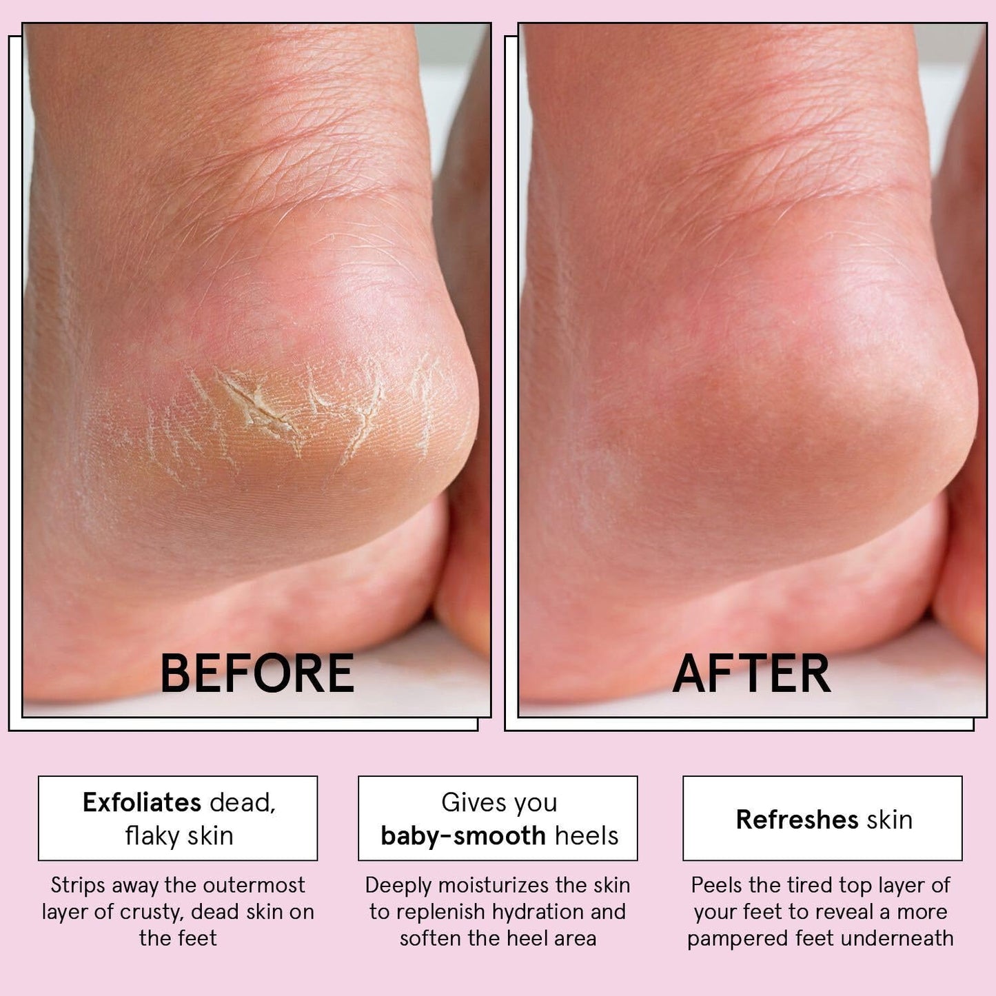 grace & stella Award-Winning Foot Peeling Mask - Foot Peel Masks with Aloe Vera- Moisturizing Foot Masks That Remove Dead Skin, Exfoliating Foot Mask for Dry Cracked Feet (4 Pairs, Unscented)