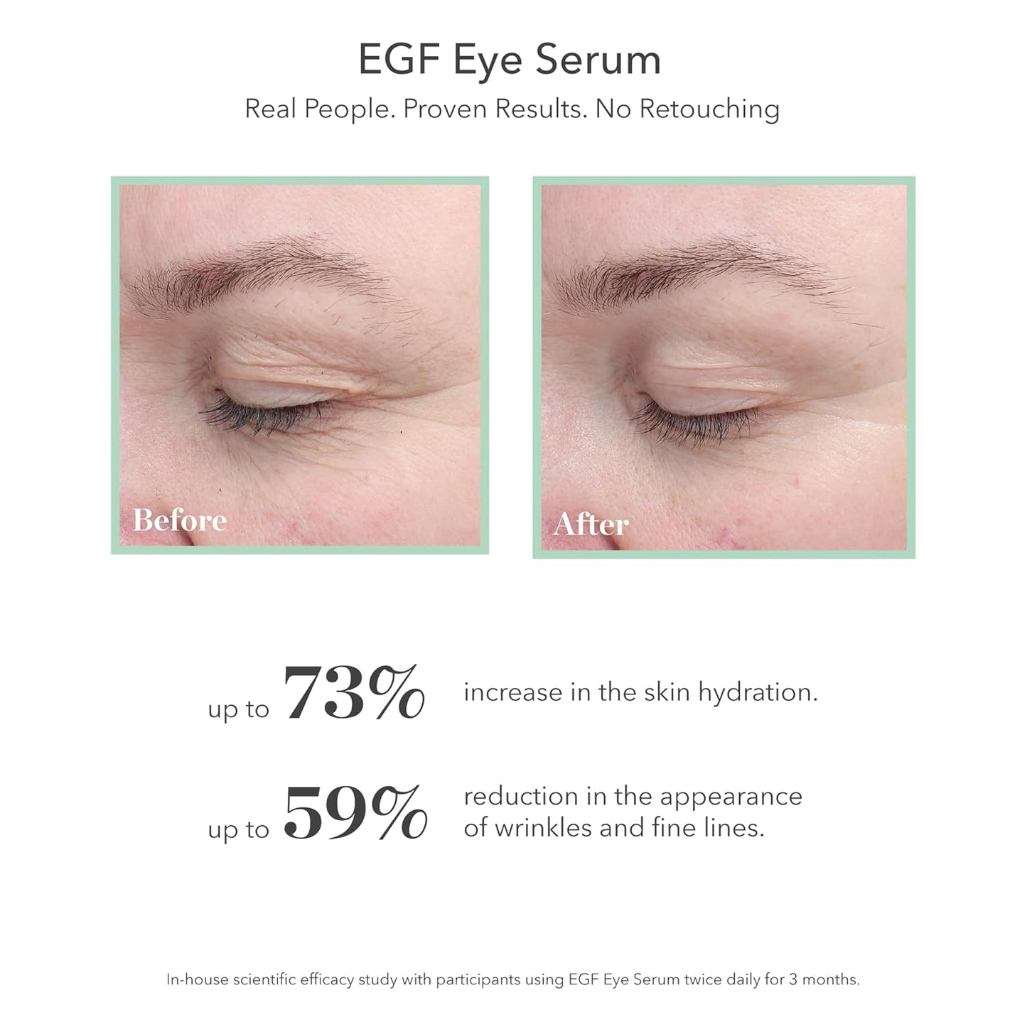 BIOEFFECT Classic Duo of EGF Serum and EGF Eye Serum plus Refill, Skincare Gift Set for Wrinkle Fighting, Moisturizing, Firming, Anti-Aging Facial Treatments featuring Barley Growth Factor