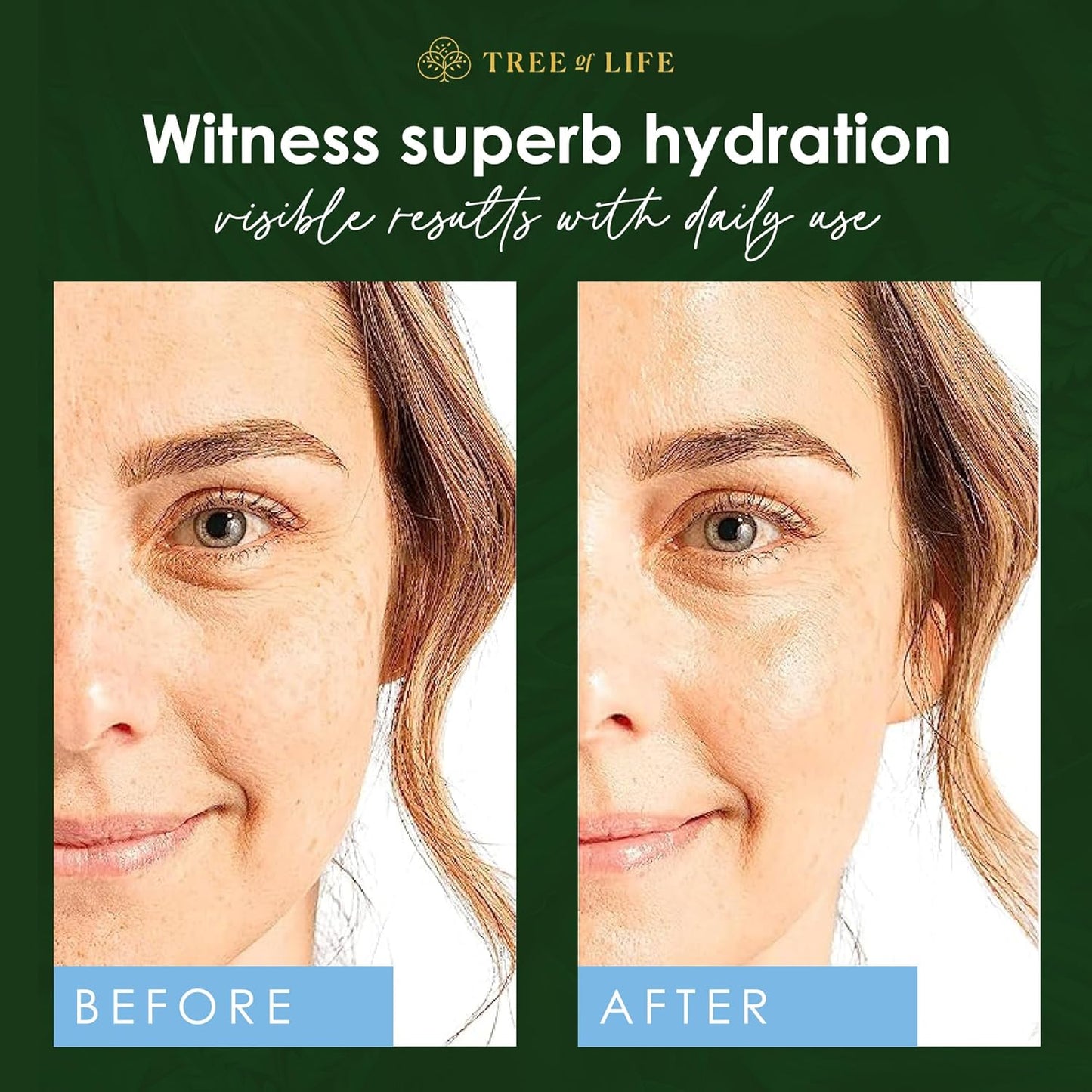 Hyaluronic Acid Serum 1oz