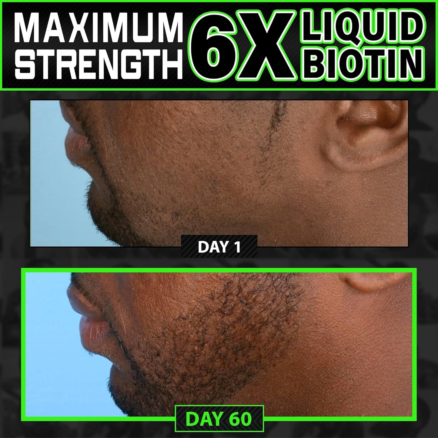 Biotin Gummies 620,000mcg + Liquid Biotin Drops with Collagen Peptides – Men's Beard Growth Kit for Thicker Fuller Beard – Beard & Hair Growth Vitamins with MSM, Keratin, Bamboo & Zinc