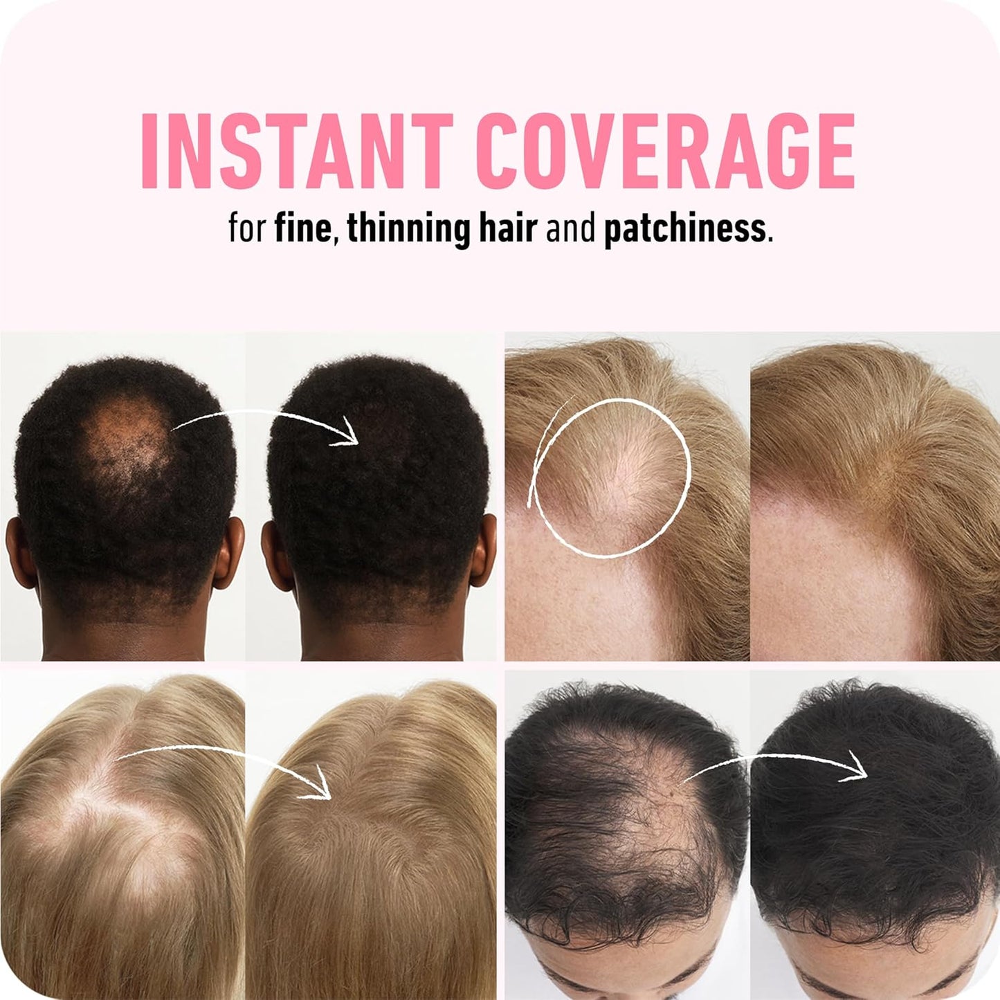 BOLDIFY Hair Fibers (12g) - Fill In Thinning and Fine Hair for an Instantly Fuller, Thicker Look - 14 Shades for Women & Men - Dark Gray