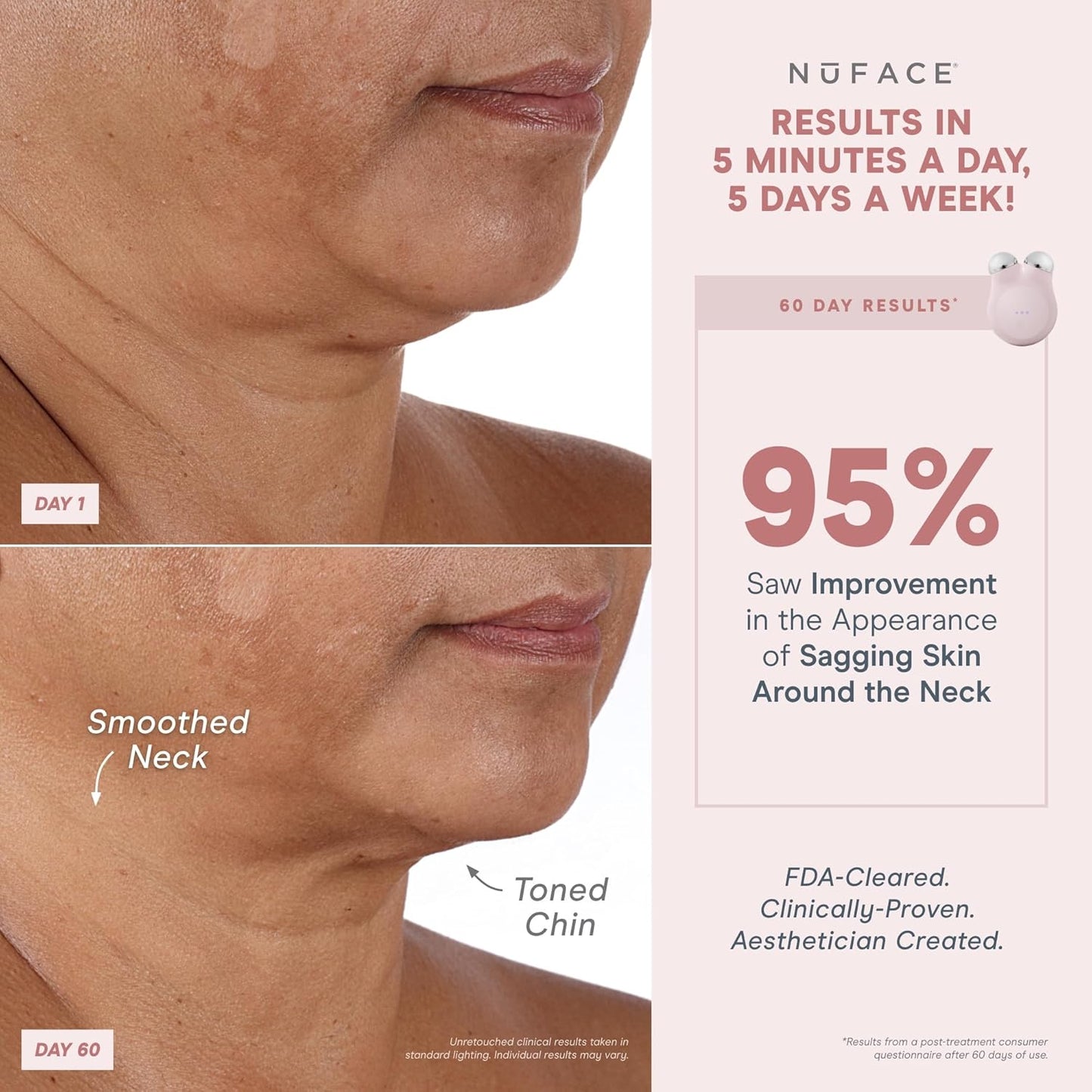 NuFACE MINI+ Microcurrent Facial Device Kit - Limited Edition FDA Cleared Face Massager Device + Microcurrent Gel Activator & Applicator Brush - Velvet Rose