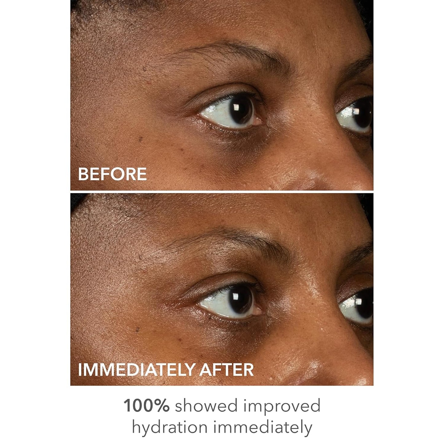 Dr Dennis Gross DermInfusions Lift + Repair Eye Mask | Visibily Lift + Firm, Fills the Appearance of Fine Lines, Hydrates + Repairs Skin Barrier, Visibly Depuffs Undereye Area | 1 Treatment 0.33 fl oz