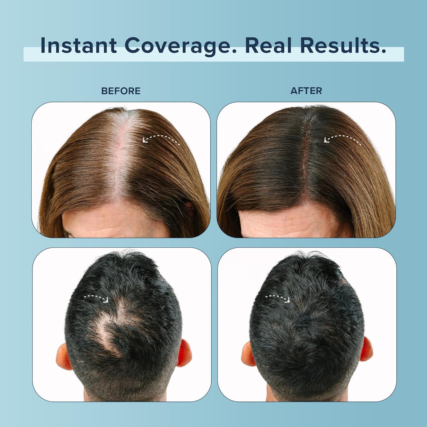 TRUHAIR Color Fibers Root Coverage & Density Booster | Quick-Apply Root Touch Up Hair Color | Natural Color Matching, Gray Hair Cover up to Color Gray Roots - 11 Hair Colors Available (Red)