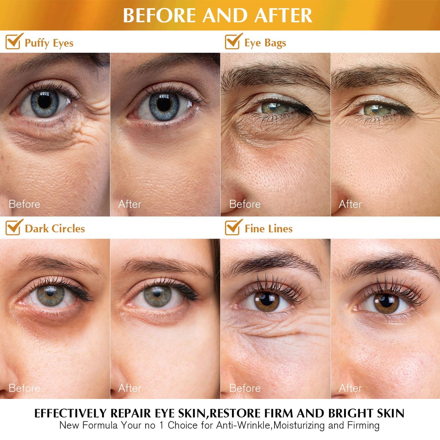 Enaskin Naturals Under Eye Patches Dark Circles Under Eye Masks for Puffiness - 24K Gold Eye Gel Pads Retinol Collagen Hyaluronic Acid Moisturizing & Reducing Wrinkles (24K Gold)