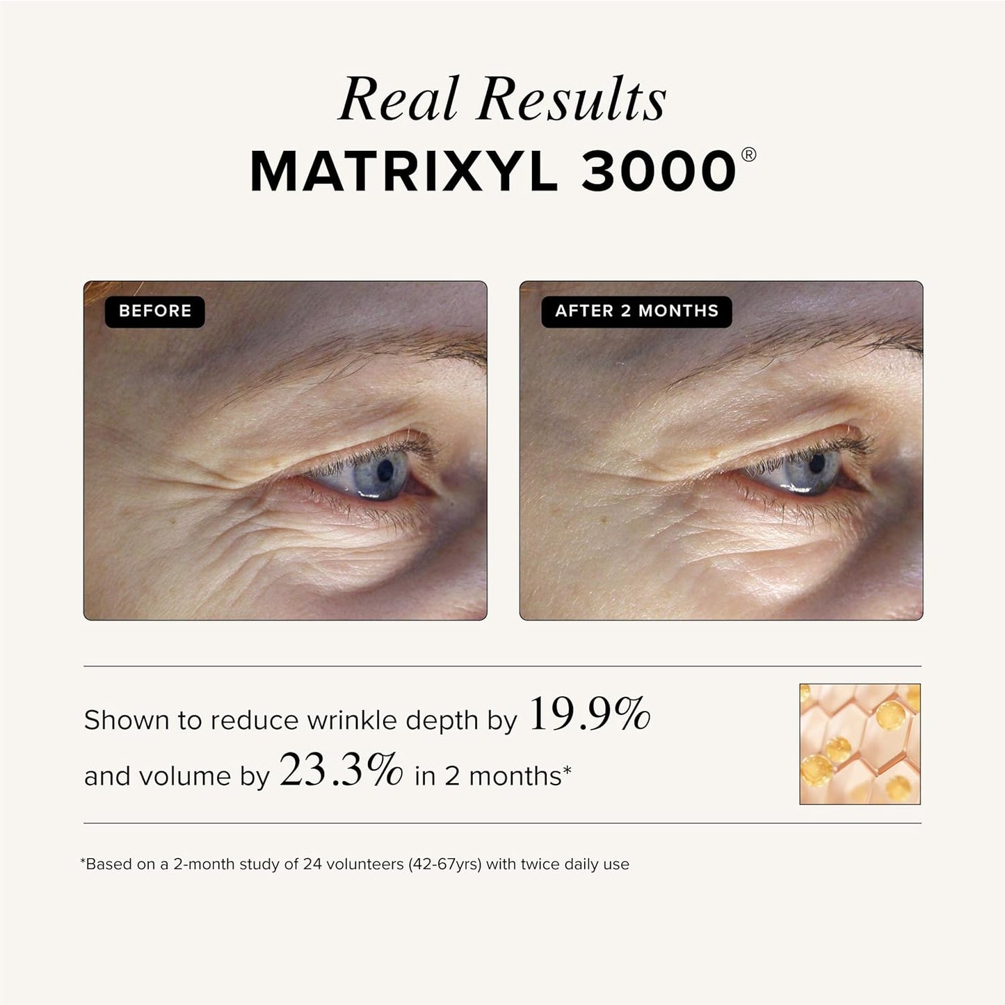 Asterwood Triple Repair Matrixyl 3000 + Argireline + Hyaluronic Acid + Vitamin C Serum for Face - Anti-Aging, Collagen Boosting, Hydrating - Fragrance-Free - 2 Fl Oz